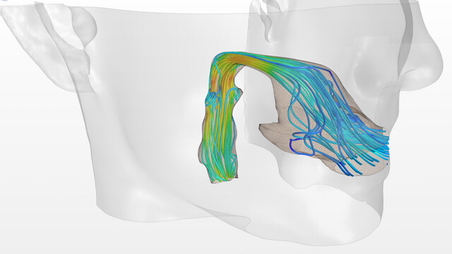 Simulation is already playing a prominent role in establishing product performance in the verification stages of device development.